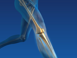 digitial image of joints