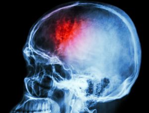 xray image of human skull