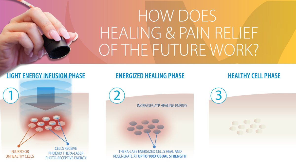 how thera lase system works